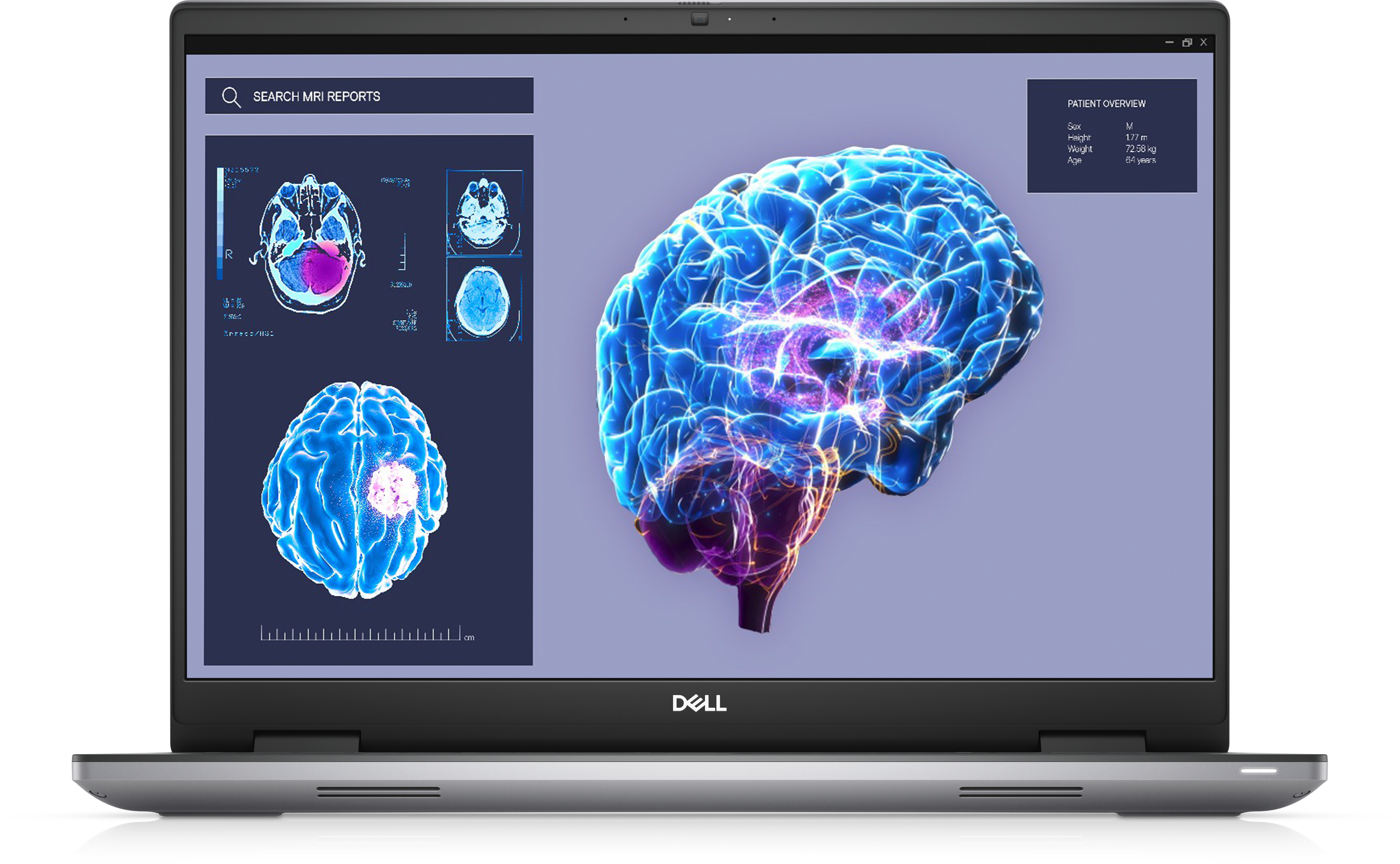 Bild von DELL Precision 7680 (MVHK0)